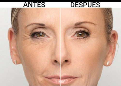Suero de Reinol Anti arrugas
